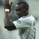 La mentira de Vincent Aboubakar: fingió una lesión porque no podía cabecear luego de realizarse un implante capilar