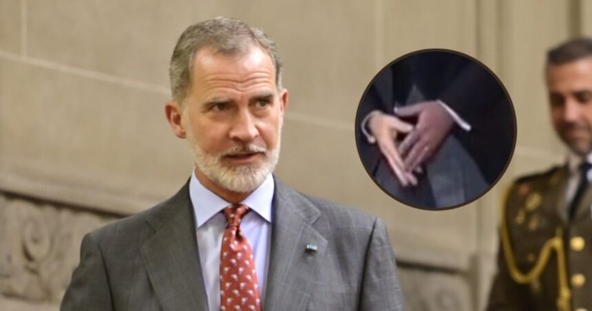 El misterio de la mano izquierda del rey Felipe VI: por qué estuvo violeta durante meses