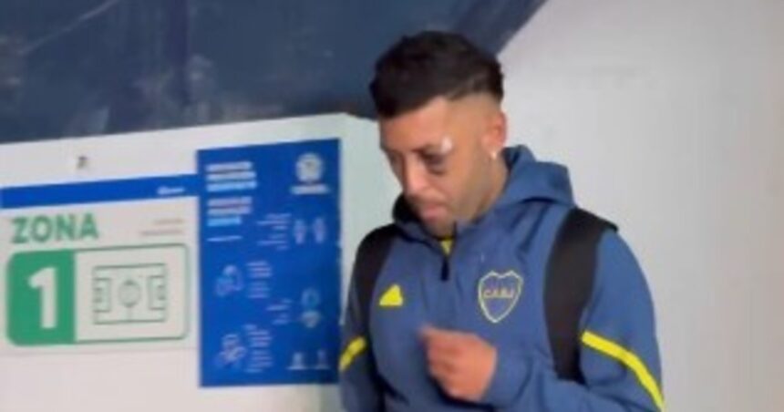 Lucas Janson salió con el ojo negro, tras el partido con Racing: qué le pasó realmente al futbolista de Boca