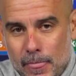 Pep Guardiola apareció lleno de arañazos en plena crisis del Manchester City y dio una extraña explicación: “Quise hacerme daño”