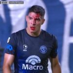 Independiente Rivadavia vs. Riestra y el partido de las polémicas: le abrieron la cabeza a un jugador y el VAR no intervino pero después resolvió una jugada complicada