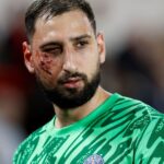 Gianluigi Donnarumma sufrió una brutal patada y terminó con la cara llena de clips: por qué no echaron al jugador del Mónaco ante el PSG