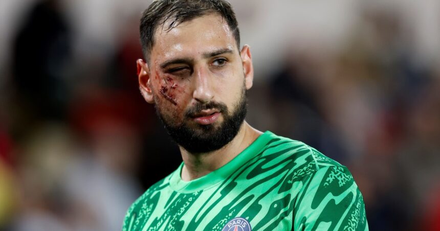 Gianluigi Donnarumma sufrió una brutal patada y terminó con la cara llena de clips: por qué no echaron al jugador del Mónaco ante el PSG